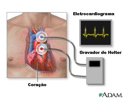 Holter - Eletrocardiografia Dinâmica de 24 horas – Biocor