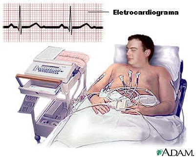 eletrocardiograma normal