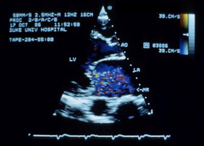 Endocardio Clínica Médica - Brusque-SC